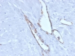 IHC staining of FFPE human pancreatic tissue with von Willebrand Factor antibody (clone VWF/4106). HIER: boil tissue sections in pH 9 10mM Tris with 1mM EDTA for 20 min and allow to cool before testing.