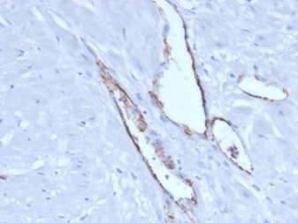 IHC staining of FFPE human pancreatic tissue with von Willebrand Factor antibody (clone VWF/4106). HIER: boil tissue sections in pH 9 10mM Tris with 1mM EDTA for 20 min and allow to cool before testing.