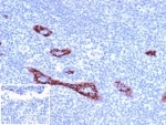 IHC staining of FFPE human tonsil tissue with von Willebrand Factor antibody (clone VWF/4106). Negative control inset: PBS used instead of primary antibody to control for secondary Ab binding. HIER: boil tissue sections in pH 9 10mM Tris with 1mM EDTA for 20 min and allow to cool before testing.
