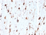 IHC staining of FFPE human brain tissue with Carbonic Anhydrase VIII antibody (clone CA8/6572). HIER: boil tissue sections in pH 9 10mM Tris with 1mM EDTA for 20 min and allow to cool before testing.