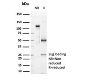 SDS-PAGE analysis of purified, BSA-free recombinant CD6 antibody (C6/7022R) as confirmation of integrity and purity.
