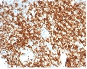 IHC staining of FFPE human tonsil tissue with recombinant CD6 antibody (clone C6/7022R). HIER: boil tissue sections in pH 9 10mM Tris with 1mM EDTA for 20 min and allow to cool before testing.