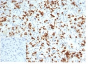 IHC staining of FFPE human spleen tissue with recombinant CD6 antibody (clone C6/7022R) at 2ug/ml in PBS for 30min RT. Negative control inset: PBS used instead of primary antibody to control for secondary Ab binding. HIER: boil tissue sections in pH 9 10mM Tris with 1mM EDTA for 20 min and allow to cool before testing.