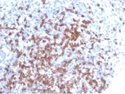 IHC staining of FFPE human tonsil tissue with CD8A antibody. HIER: boil tissue sections in pH 9 10mM Tris with 1mM EDTA for 20 min and allow to cool before testing.