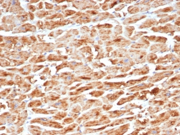 IHC staining of FFPE human heart tissue with recombinant SDHB antibody (clone SDHB/6697R). HIER: boil tissue sections in pH 9 10mM Tris with 1mM EDTA for 20 min and allow to cool before testing.~