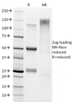 SDS-PAGE analysis of purified, BSA-free Helicobacter pylori antibody (clone HP/1336) as confirmation of integrity and purity.