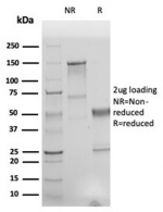 SDS-PAGE analysis of purified, BSA-free recombinant Human Nuclear Antigen antibody (r235-1) as confirmation of integrity and purity.