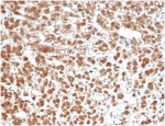 IHC staining of FFPE human adrenal gland tissue with IL1 beta antibody (clone IL1B/6687) at 2ug/ml. HIER: boil tissue sections in pH 9 10mM Tris with 1mM EDTA for 20 min and allow to cool before testing.