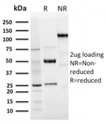 SDS-PAGE analysis of purified, BSA-free recombinant Langerin antibody (LGRN/3136R) as confirmation of integrity and purity.