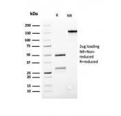 SDS-PAGE analysis of purified, BSA-free Bcl-2 antibody (SPM117) as confirmation of integrity and purity.