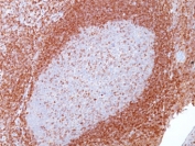 IHC staining of FFPE human tonsil tissue with Bcl-2 antibody (clone SPM117). HIER: boil tissue sections in pH 9 10mM Tris with 1mM EDTA for 20 min and allow to cool before testing.