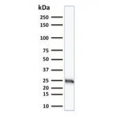 Western blot analysis of human MCF-7 cell lysate using Bcl-2 antibody (clone SPM117).