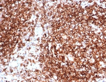 IHC staining of FFPE human tonsil tissue with Pan-HLA antibody (clone HLA-Pan/6663). HIER: boil tissue sections in pH 9 10mM Tris with 1mM EDTA for 20 min and allow to cool before testing.~