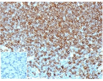 IHC staining of FFPE human lymph node tissue wi