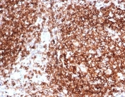 IHC staining of FFPE human tonsil tissue with Pan-HLA antibody (clone HLA-Pan/6663). HIER: boil tissue sections in pH 9 10mM Tris with 1mM EDTA for 20 min and allow to cool before testing.