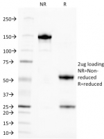 SDS-PAGE analysis of purified, BSA-free TAG-72 antibody (CA72/145) as confirmation of integrity and purity.