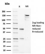 SDS-PAGE analysis of purified, BSA-free Muscle Actin antibody (clone rMSA/953) as confirmation of integrity and purity.