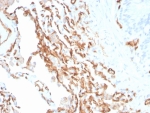 IHC staining of FFPE human colon tissue with PECAM1 antibody (clone PECAM1/3534). HIER: boil tissue sections in pH 9 10mM Tris with 1mM EDTA for 20 min and allow to cool before testing.