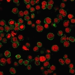 Immunofluorescent staining of human Jurkat cells using PECAM1 antibody (green, clone PECAM1/3534) and RedDot (red).