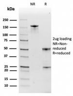 SDS-PAGE analysis of purified, BSA-free Haptoglobin antibody (HP/3835) as confirmation of integrity and purity.