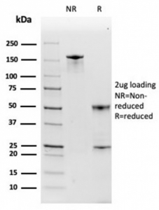 SDS-PAGE analysis of purified, BSA-free Haptoglobin antibody (HP/3835) as confirmation of integrity and purity.