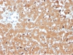 IHC staining of FFPE human liver tissue with Haptoglobin antibody (clone HP/3835) at 2ug/ml. HIER: boil tissue sections in pH 9 10mM Tris with 1mM EDTA for 20 min and allow to cool before testing.