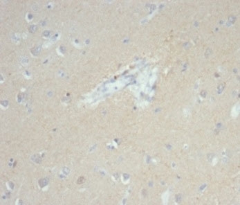 IHC staining of FFPE human brain tissue with recombinant EpCAM antibody (clone EGP40/7035R). HIER: boil tissue sections in pH 9 10mM Tris with 1mM EDTA for 20 min and allow to cool before testing.