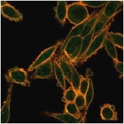 Immunofluorescent staining of PFA-fixed human HeLa cells using SMAD9 antibody (green, clone PCRP-SMAD9-2F4) and phalloidin (red).