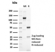 SDS-PAGE analysis of purified, BSA-free recombinant PAX6 antibody (clone PAX6/7078R) as confirmation of integrity and purity.