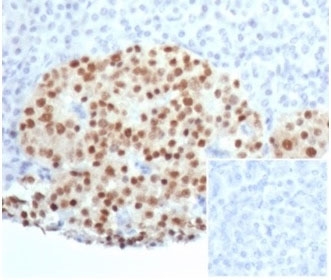 IHC staining of FFPE human pancreatic tissue with recombinant PAX6 antibody (clone PAX6/7078R). Negative control inset: PBS instead of primary antibody to control for secondary binding. HIER: boil tissue sections in pH 9 10mM Tris with 1mM EDTA for 20 min and allow to cool before testing.~