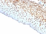 Recombinant Nuclear Antigen Antibody Human Tonsil Tissue IHC. Immunohistochemistry staining of FFPE human tonsil tissue using Pan-Nuclear Antigen Antibody (clone rNM106) demonstrates strong nuclear HRP-DAB brown staining throughout lymphoid cell populations. The staining pattern is consistent with recognition of a broadly expressed nuclear-associated antigen present within the nuclei of diverse cell types. Distinct nuclear localization provides clear visualization of cellular distribution, tissue architecture, and nuclear morphology while minimizing background staining in non-nuclear compartments. As a pan-nuclear marker, clone rNM106 is useful for identification of cell nuclei, assessment of tissue organization, and subcellular localization studies in both normal and pathological specimens. The observed staining highlights widespread nuclear labeling throughout the tonsillar lymphoid compartment and demonstrates the utility of this recombinant antibody for nuclear visualization applications.