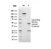 SDS-PAGE analysis of purified, BSA-free recombinant Nuclear Antigen antibody (clone rNM106) as confirmation of integrity and purity.