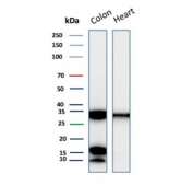 Western blot testing of human colon and heart tissue lysate with recombinant Galectin 3 antibody (clone LGALS3/7036R). Predicted molecular weight ~26 kDa.
