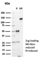 SDS-PAGE analysis of purified, BSA-free Galectin 3 antibody (LGALS3/7036R) as confirmation of integrity and purity.