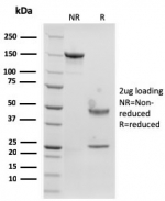SDS-PAGE analysis of purified, BSA-free recombinant Langerin antibody (clone rLGRN/1821) as confirmation of integrity and purity.