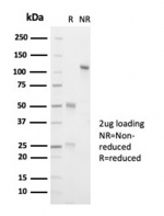 SDS-PAGE analysis of purified, BSA-free recombinant ALK antibody (clone ALK1/7008R) as confirmation of integrity and purity.