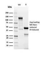 SDS-PAGE analysis of purified, BSA-free recombinant TdT antibody (clone DNTT/4617R) as confirmation of integrity and purity.