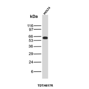 TdT Antibody MOLT4 WB. Western blot analysis of human MOLT4 cell lysate using TdT antibody detecting terminal deoxynucleotidyl transferase (DNTT), clone TDT/4617R. A band is observed at approximately 58-65 kDa, consistent with the expected molecular weight of TdT, a nuclear DNA polymerase expressed in immature lymphoid cells and commonly associated with lymphoblastic leukemia models