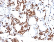 IHC staining of FFPE human bone marrow tissue with Resistin antibody (clone RETN/3331). HIER: boil tissue sections in pH 9 10mM Tris with 1mM EDTA for 20 min and allow to cool before testing.