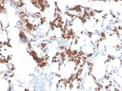 IHC staining of FFPE human bone marrow tissue with Resistin antibody (clone RETN/3331). HIER: boil tissue sections in pH 9 10mM Tris with 1mM EDTA for 20 min and allow to cool before testing.