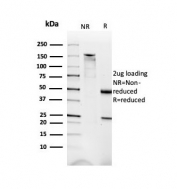 SDS-PAGE analysis of purified, BSA-free DMD antibody (clone DMD/3676) as confirmation of integrity and purity.
