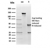 SDS-PAGE analysis of purified, BSA-free IGF1R antibody (clone IGF1R/4667) as confirmation of integrity and purity.