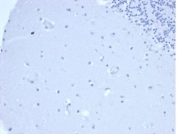 Negative control: IHC staining of FFPE human brain tissue using recombinant Prolactin antibody (clone PRL/4906R) at 2ug/ml in PBS for 30min RT. HIER: boil tissue sections in pH 9 10mM Tris with 1mM EDTA for 20 min and allow to cool before testing.