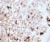 IHC staining of FFPE human pituitary tissue with recombinant Prolactin antibody (clone PRL/4906R). HIER: boil tissue sections in pH 9 10mM Tris with 1mM EDTA for 20 min and allow to cool before testing.