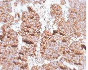 IHC staining of FFPE human pituitary tissue with recombinant Prolactin antibody (clone PRL/4906R). HIER: boil tissue sections in pH 9 10mM Tris with 1mM EDTA for 20 min and allow to cool before testing.