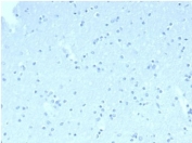 Negative control: IHC staining of FFPE human brain tissue with CD23 antibody (clone FCER2/6890) at 2ug/ml in PBS for 30min RT. HIER: boil tissue sections in pH 9 10mM Tris with 1mM EDTA for 20 min and allow to cool before testing.