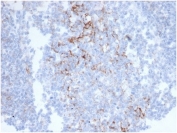 IHC staining of FFPE human colon tissue with CD23 antibody (clone FCER2/6890) at 2ug/ml in PBS for 30min RT. HIER: boil tissue sections in pH 9 10mM Tris with 1mM EDTA for 20 min and allow to cool before testing.