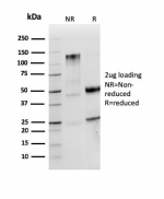 SDS-PAGE analysis of purified, BSA-free recombinant Lambda Light Chain antibody (clone LLC/3774R) as confirmation of integrity and purity.