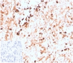 IHC staining of FFPE human spleen tissue with recombinant Lambda Light Chain (clone LLC/3774R). Negative control inset: PBS instead of primary antibody to control for secondary binding. HIER: boil tissue sections in pH 9 10mM Tris with 1mM EDTA for 20 min and allow to cool before testing.