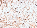 IHC staining of FFPE human spleen tissue with recombinant Lambda Light Chain antibody (clone LLC/3774R). HIER: boil tissue sections in pH 9 10mM Tris with 1mM EDTA for 20 min and allow to cool before testing.